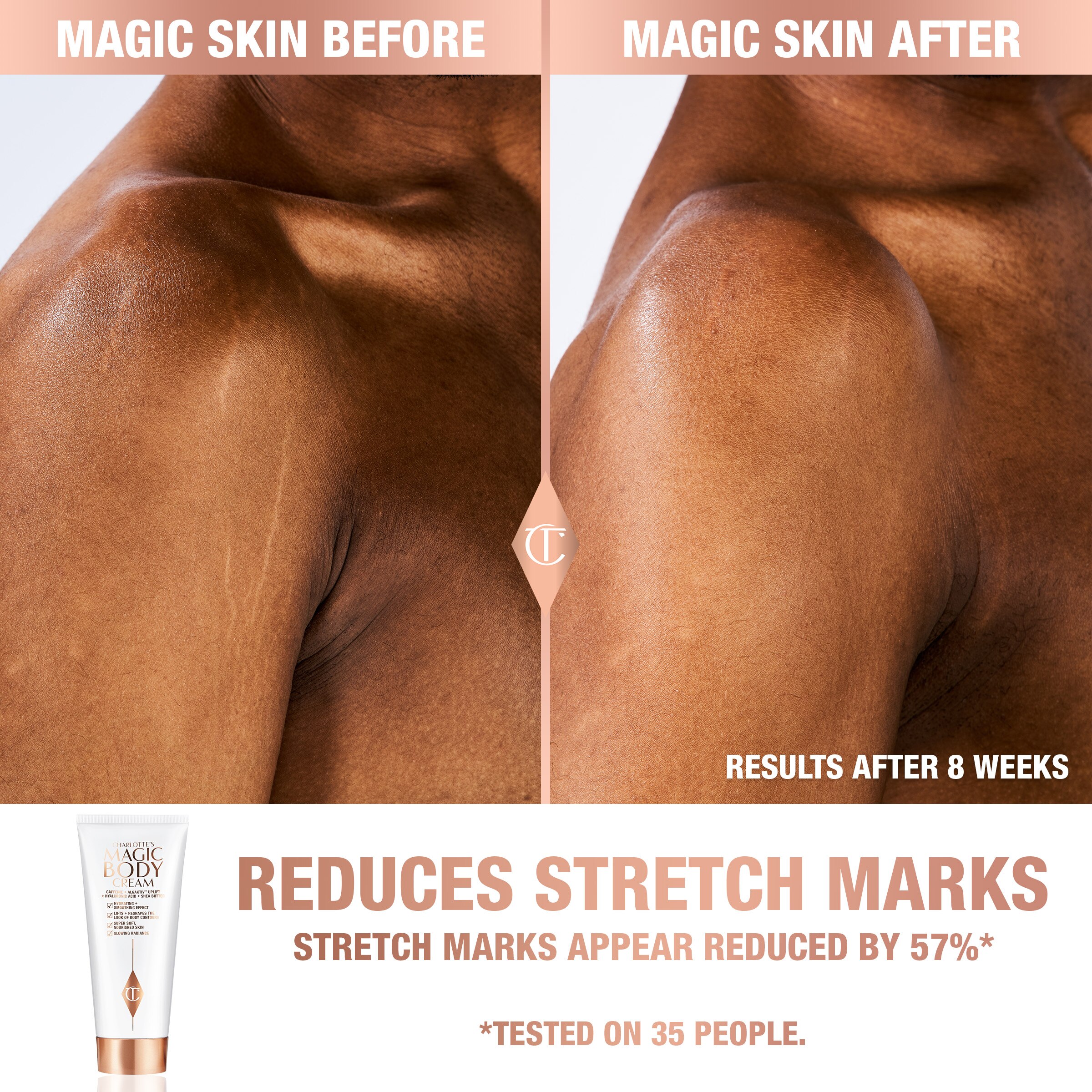 CHARLOTTE'S MAGIC BODY CREAM  (TRATAMIENTO CORPORAL HIDRATANTE)
